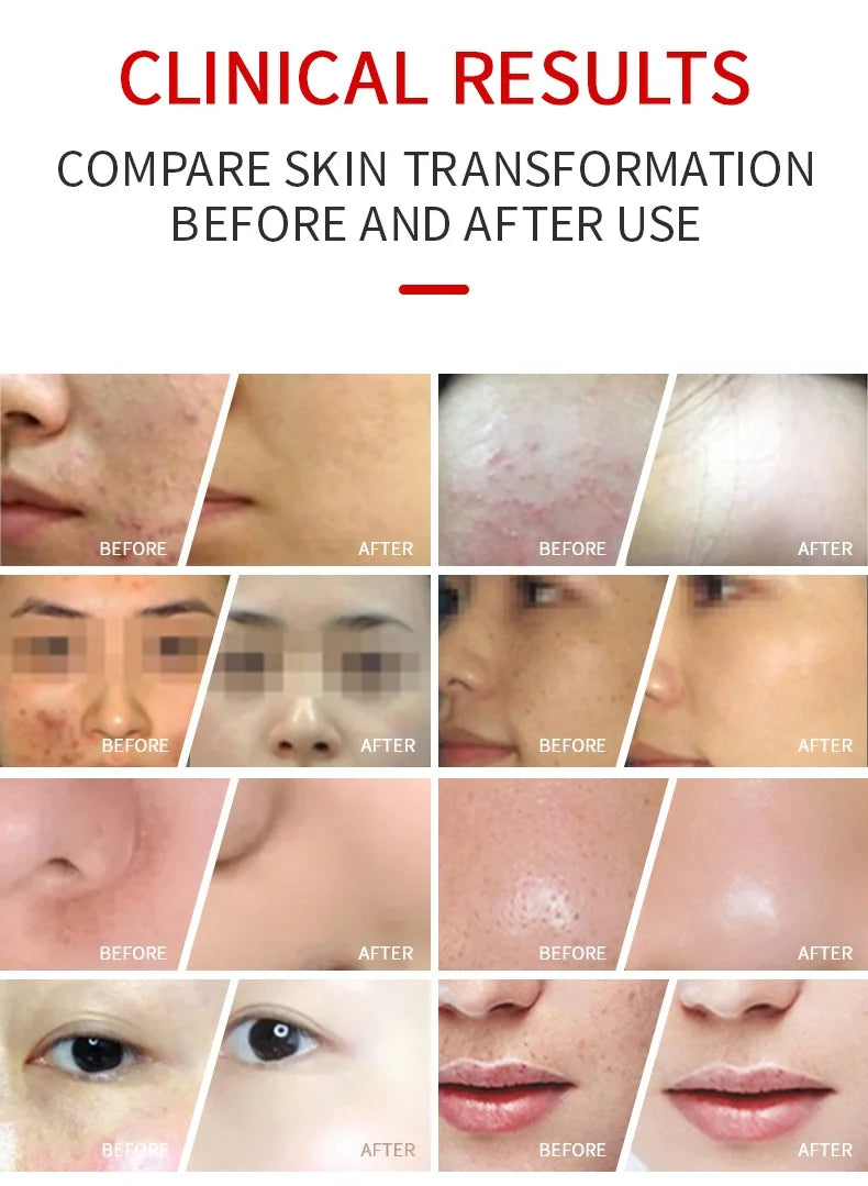 7 Color LED Facial Mask High Frequency Nano Spray Infrared Photo Therapy Red Light Therapy for Face Skin Rejuvenation Tool